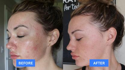 Bloomin's 345 Relief Cream