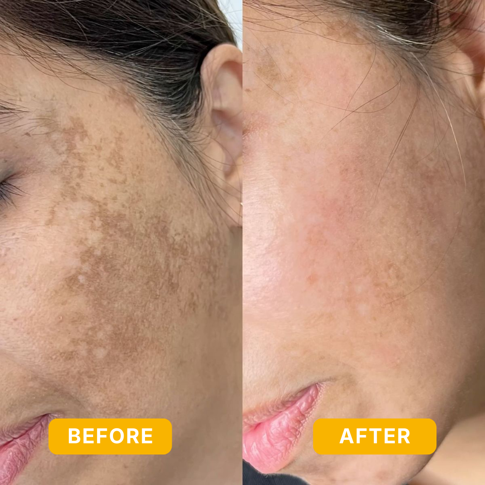 Bloomin's Dark Spot Vitamin C Serum