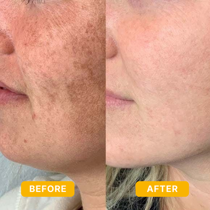 Bloomin's Dark Spot Vitamin C Serum